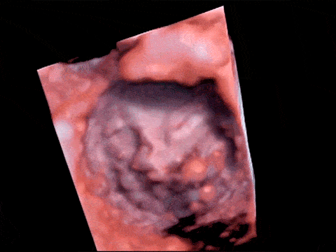 1.gif
