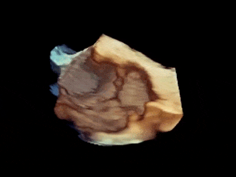 3.gif
